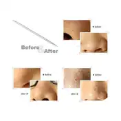 Bronson Professional Black Head Remover Tool - Pointed (1 pc)