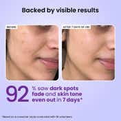 Foxtale 5% Niacinamide Face Serum With Olive Leaf Extract (30ml)