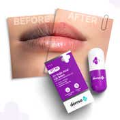 The Derma Co. 1% Kojic Acid Lip Balm (4.5 g)