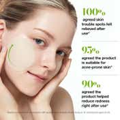 Anua Azelaic 10 Hyaluron Redness Soothing Pad (230 ml)