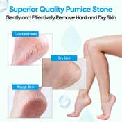 Vega Pumice Stone for Feet, Foot Scrubber for Dead Skin Removal (PD-29)