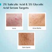 Pilgrim Salicylic Acid & Niacinamide Oil Control Serum (30ml)