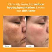 Conscious Chemist 10% Vitamin C Face Serum (Advanced) With Peptide For Glowing Skin (30ml)