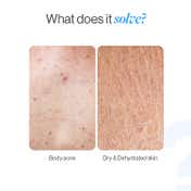 Be Bodywise 1% Salicylic Ceramide - Dual Pump 2in1 Body Wash (200 ml)