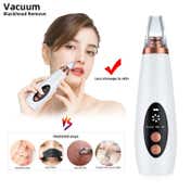 SEMINO Professional Blackhead Remover Dermasuction Machine With 6 Nozzles - White