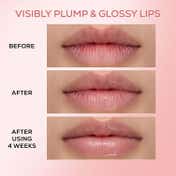 RENEE PDRN Moisturizing Lip Balm For Dry & Chapped Lips - Pink Therapy (10 g)