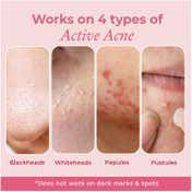 The Pink Foundry Overnight Acne Spot Corrector (30ml)