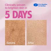 Vaseline Gluta Hya Dewy Radiance Non-Sticky Body Lotion, GlutaGlow, Hyaluron, Niacinamide (200ml)