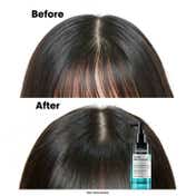 L'OREAL PROFESSIONNEL Scalp Advanced 5-in-1 Professional Leave-in Serum for Scalp Care (90 ml)