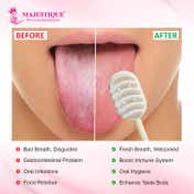 Majestique Soft Silicone Tongue Cleaner for Adults