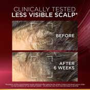 L'Oreal Paris Fall Resist Anti Hair Fall Serum with 1.5% Aminexil Caffeine & Arginine (102 ml)