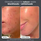 PAULA'S CHOICE Skin Perfecting 2% BHA Liquid - Travel Size (30 ml)