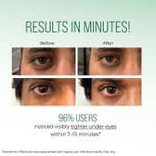 Dr. Sheth's Copper & Argireline Peptide B'tox Eye Cream (15 g)