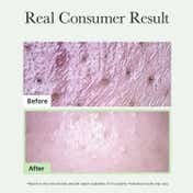 Arencia Fresh Green Rice Mochi Cleanser - Clarifying Korean Cleanser for Acne-Prone Skin (120 g)