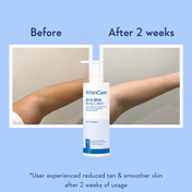 WishCare AHA + BHA Exfoliating Body Lotion Provides Deep Hydration and Detan Skin (200 ml)