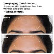 Foxtale 0.15% Encapsulated Retinol Night Serum (30ml)