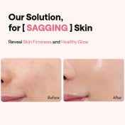 MEDIHEAL Collagen Firming Volume Serum (40 ml)