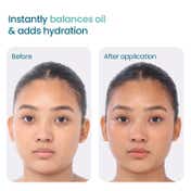 WishCare 2:1:3 NMF Oil Free Water Gel Moisturizer for Oily -Acne Prone Skin with Niacinamide (50 ml)