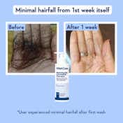 WishCare Multi Peptide Anti Hairfall Shampoo with Rosemary Boosts Hair Growth (250 ml)