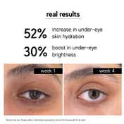 Inde Wild Luminary Eye Concentrate Dark Circles Reduction Eye Cream (15 ml)