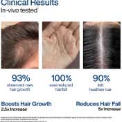 Wishcare Foaming Hair Growth Serum Redensyl Anagain Biotin Keratin & Rice PDRN (50 g)