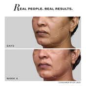 Novology Pro-Lift Cellular Restoration Anti-Ageing Serum, For Fine Lines, Dark Spots, Wrinkles (28ml)