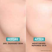 POND'S Light Moisturiser with Cera-Hyamino for 5X Dryness Repair for Soft Smooth Skin (200 ml)