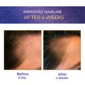 Streax Vitagrowth Hair Serum (30 ml)