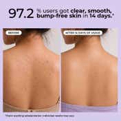 Foxtale Exfoliating Body Wash 2% Salicylic Acid Zinc PCA Reduces Body Acne Smoothens Skin (250 ml)