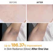 Dr.Melaxin Peel Shot Exfoliating Kojic Acid Turmeric Spray (200 ml)