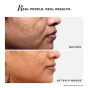 Novology Bi-Phasic Serum for Hyperpigmentation,Dark Spots,Blemishes & Acne Marks, Dermat Tested (10ml)