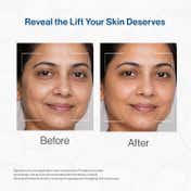 FCL Face Lift Matrix with Retinal & Matrixyl 3000 for Wrinkle & Fine Line (30 g)