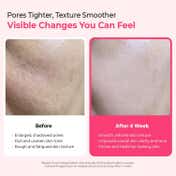 Dr.Melaxin Cemenrete Cyano Pink Spicule Serum Microneedling Serum for Wrinkle & Pore Care (30 ml)