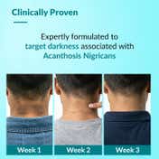 Fixderma Nigrifix Advance Cream For Dark Body Parts (50 g)