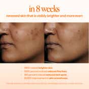 d'you Embrace Pro-Aging Retinoid Treatment (30 ml)