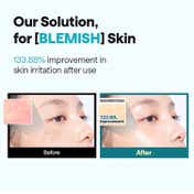 MEDIHEAL Madecassoside Essential Mask for Blemish Repair (24 ml)