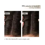 mCaffeine Naked & Raw Coffee Scalp Scrub for Dandruff Control & Scalp Exfoliation - (250g)