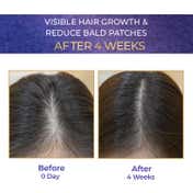 Streax Vitagrowth Hair Serum (30 ml)