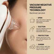 Signaxo ClearPore Rechargeable Vacuum Acne Pore & Blackhead Cleaner (1 pc)