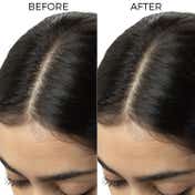 Brillare 5% Tea Tree Hair Oil Shots for Dandruff and Itchy Scalp with 1% Salicylic Acid (48 ml)