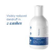 Be Bodywise 1% Ketoconazole Dandruff Shampoo (150ml)
