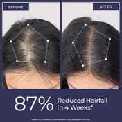 Conscious Chemist Hair Growth & Anti Hair Fall Serum (30 ml)