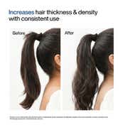 WishCare Hair Growth Serum Concentrate with Redensyl In Vivo Tested Boosts Hair Growth (20 ml)
