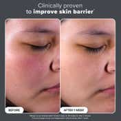 PAULA'S CHOICE Skin Perfecting 2% BHA Liquid - Travel Size (30 ml)
