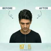 KT MEN Anti-Dandruff Lock Control Conditioning Shampoo - RCB (200 ml)