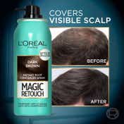 L'Oreal Paris Magic Retouch Root Touch Up Hair Color Spray - 2 Dark Brown (75 ml)