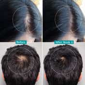 Pilgrim Redensyl & Anagain Advanced Hair Growth Serum (50 ml)