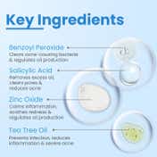 FCL 2% Benzoyl Peroxide BProx 10 Wash For Acne Exfoliate Blackheads Controls Cleanser (100ml)