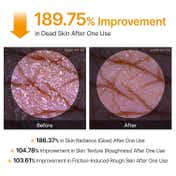 Dr.Melaxin Peel Shot Exfoliating Kojic Acid Turmeric Spray (200 ml)