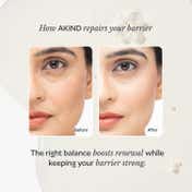 Akind Sleep Tight Firming Serum Mini (16.8 ml), Anti-Ageing & Fine Lines with 0.015% Retinol & AHA